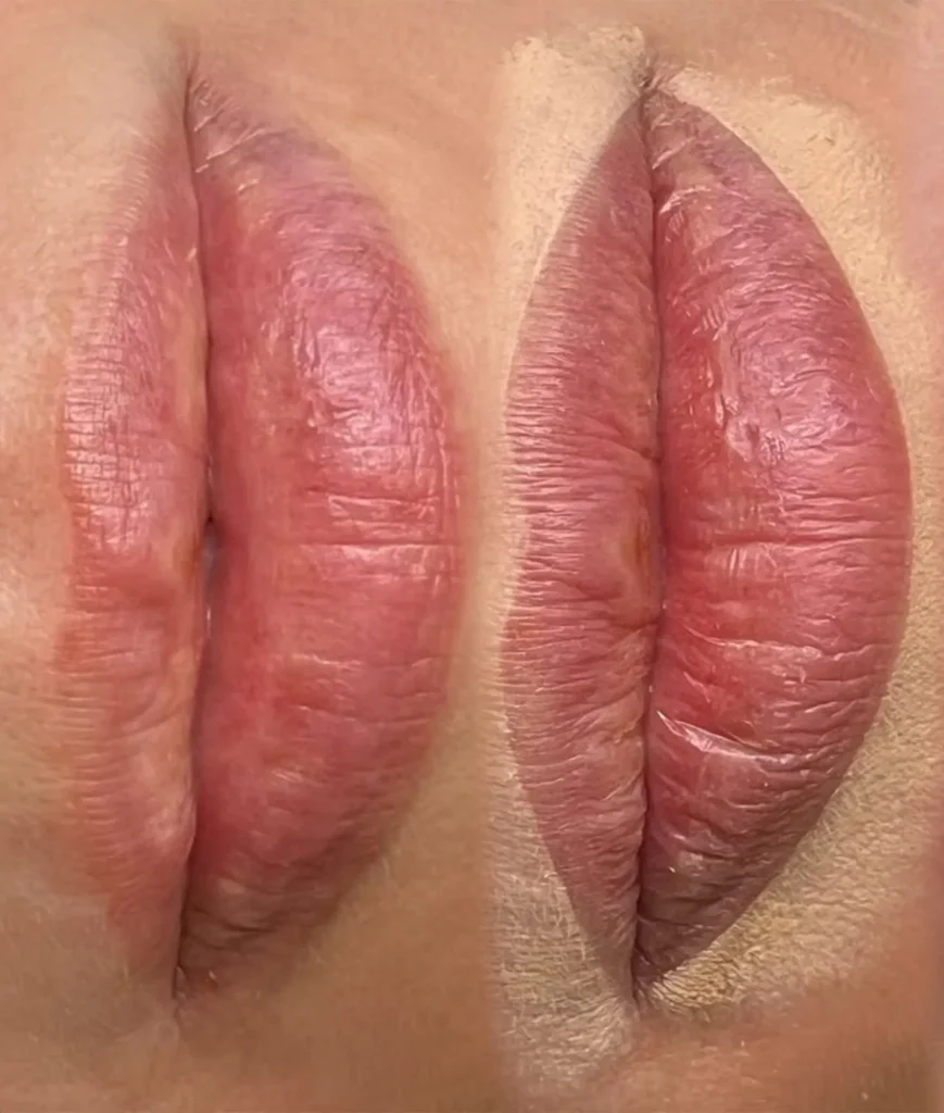 lip blush tattoo Melbourne