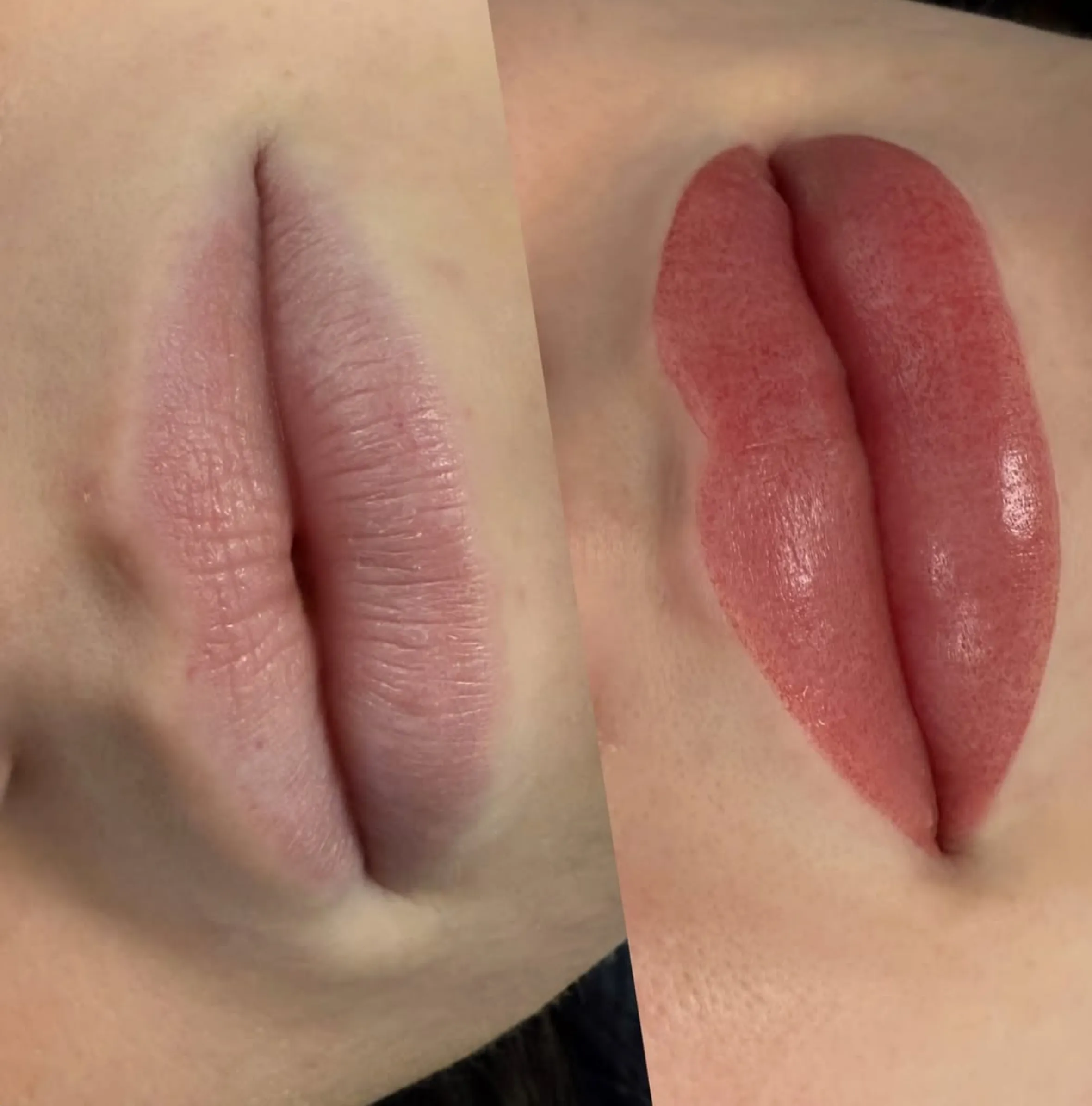 lip tattoo pigment fading causes