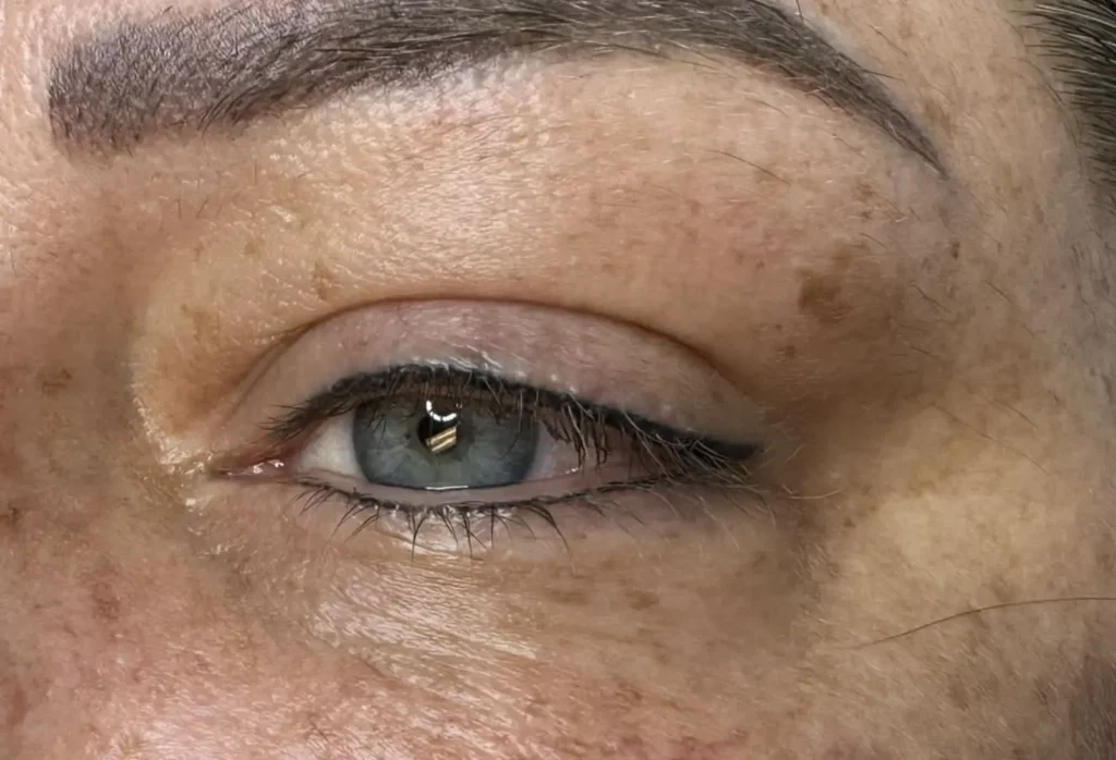 contact lenses after eyeliner tattoo